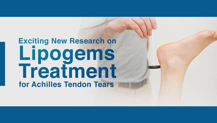 Exciting New Research on Lipogems Treatment for Achilles Tendon Tears