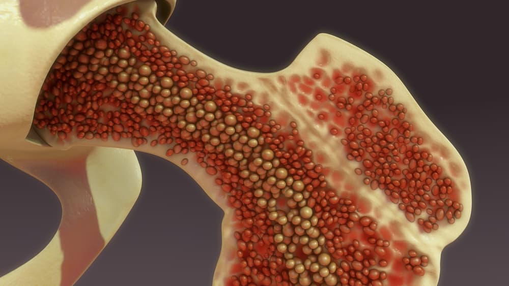 bone-marrow-derived-cells