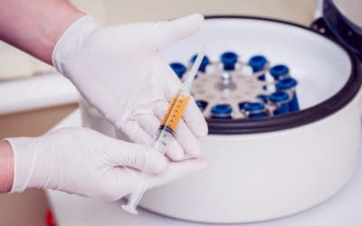 PRP Dosing: Things to Know