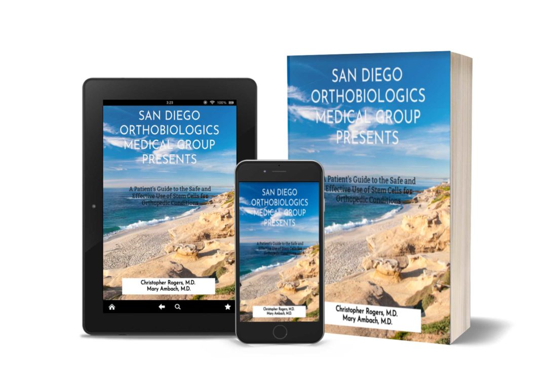 Orthopedic Regenerative Medicine Doctors in San Diego, CA