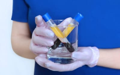 Benefits of Platelet Rich Plasma Treatments
