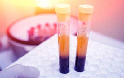 How Are Cell Based Therapies Performed?