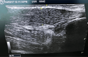 musculoskeltal ultrasound