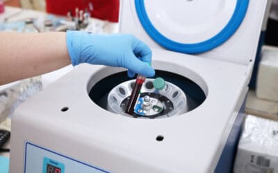 What Conditions Can Orthobiologics Treat?