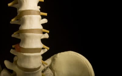 Procedures to Treat Facet Joint Pain