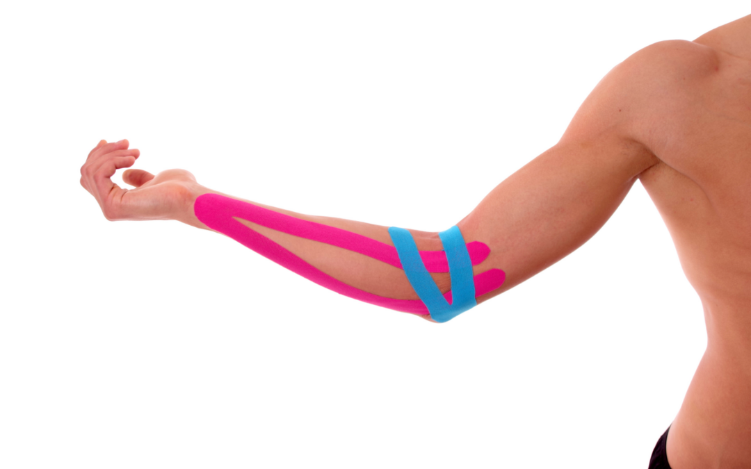 tennis elbow with tape