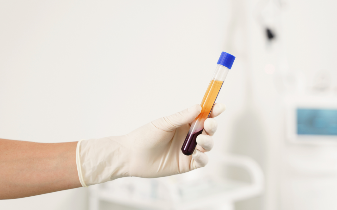 PRP injection therapy