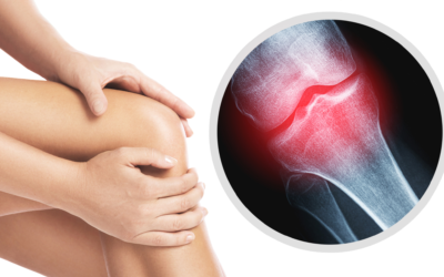 How PRP and Cell Therapy Work for Joint Pain: A Guide to Regenerative Relief