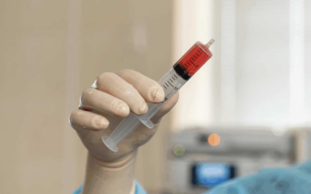 Bone Marrow Concentrate Explained