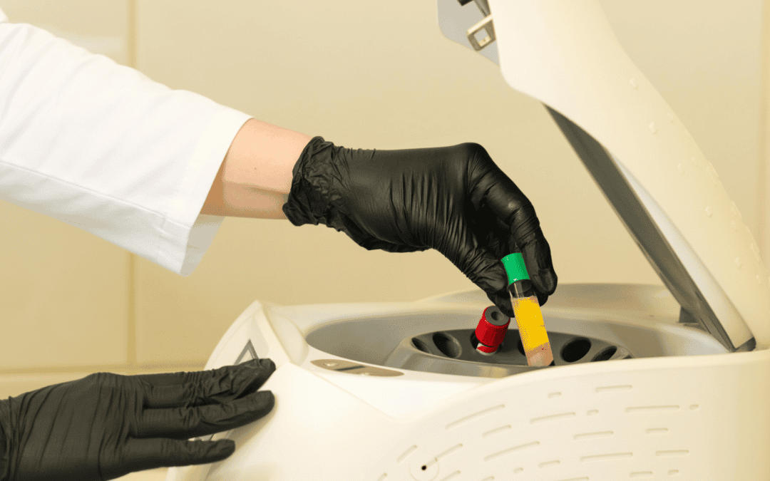 PRP therapy explained